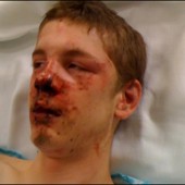 Seattle Teen Beaten by Black Muslim, Ahmed Mohamed – Beating Classified as Hate Crime